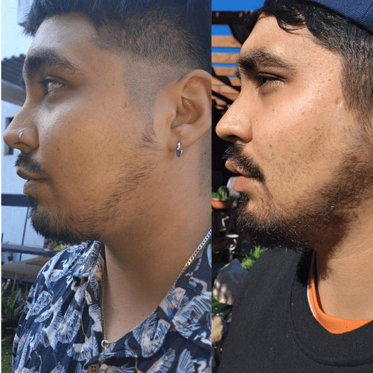 Pack 3 Meses Tónico de Crecimiento Barba & Cabello