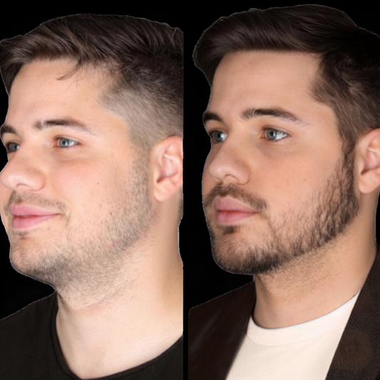 Productos para Hacer Crecer la Barba: Qué Funciona Realmente