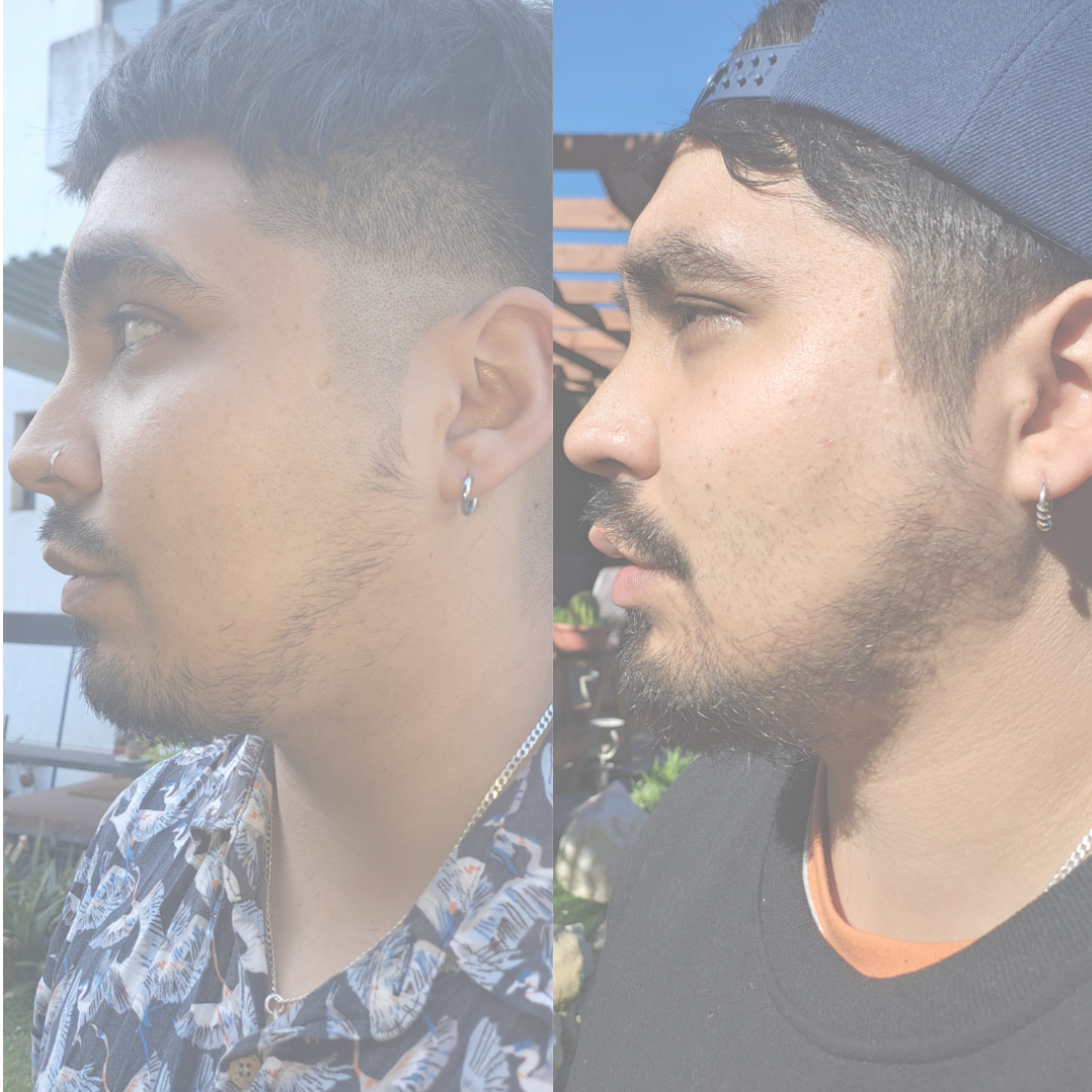 Foto de antes y después de un chico mostrando el crecimiento de su barba